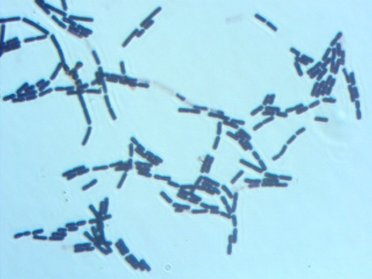 széna bacillus saprotroph vagy parazita